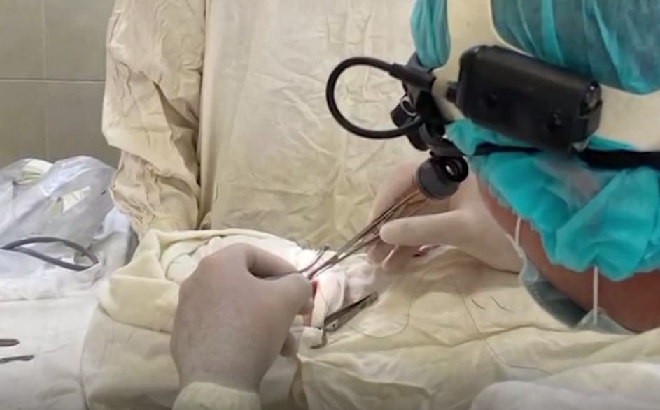 Нижегородские медики помогли девушке с сантиметровой дырой в носу  - фото 1