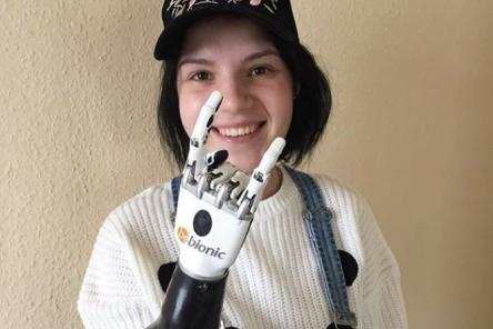 Потерять руку и жить дальше: Маргарита Грачева о дне трагедии, недостатках протезов и злых языках